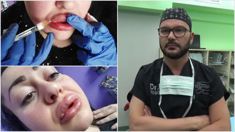 Опасното модерно: Заради лайкове, жена публикува снимки как сама си инжектира хиалурон в устните