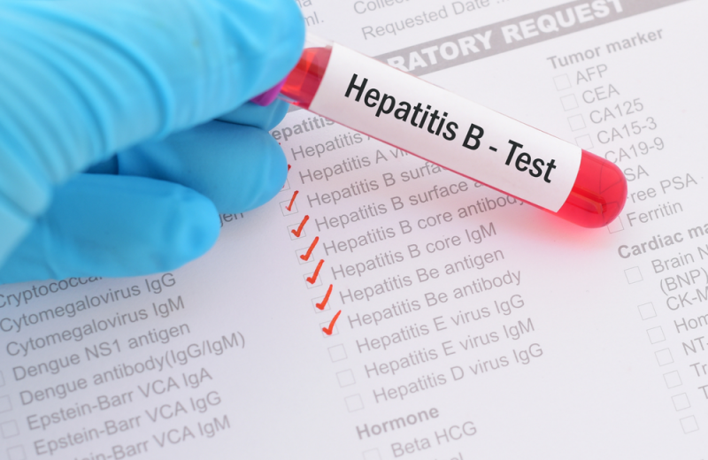Рязко повишение на случаите на хепатит в цялата страна