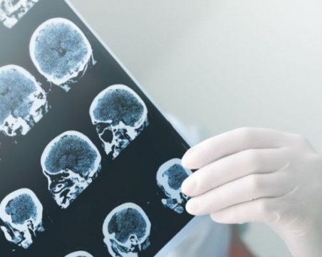 Половината от случаите на епилепсия са при деца