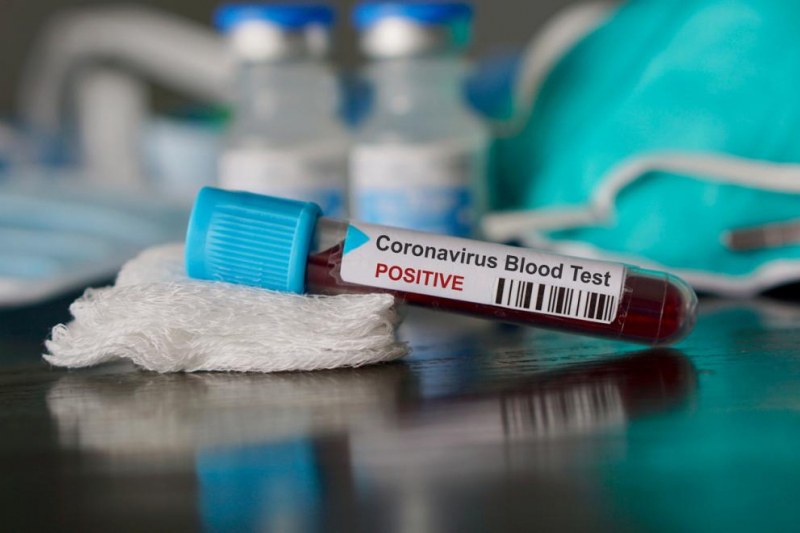Първа жертва на коронавирус в Европа