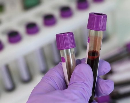 Кантарджиев: Не ходете на Женския пазар да търсите тестове за коронавирус