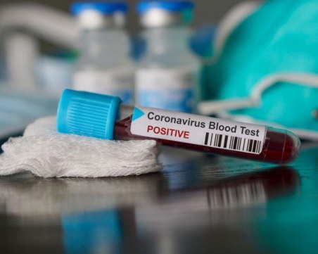 Обявиха резултатите от всички 46 проби, изследвани за коронавирус у нас