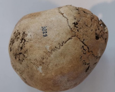 Археологически артефакти показват в Музея на медицината