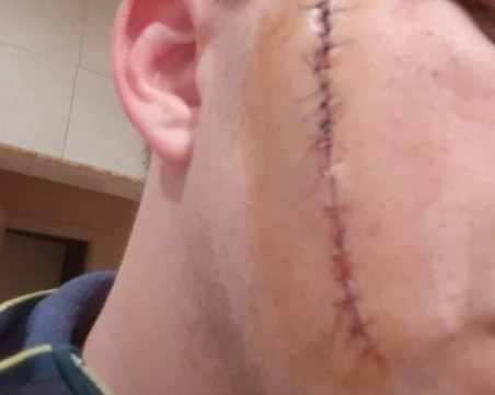 Фенове на Левски пребиха двама мъже заради шал на ЦСКА