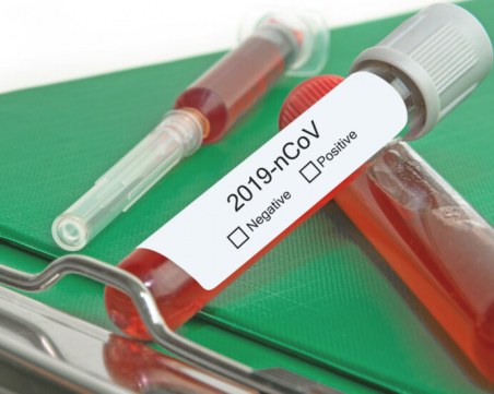 Всички 83 проби, изследвани днес за коронавирус, са отрицателни