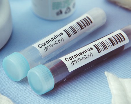 Българска студентка в Лондон се съгласила да я заразят с коронавирус