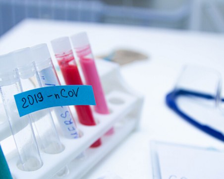 Жена припадна във Варна, съмняват се за коронавирус