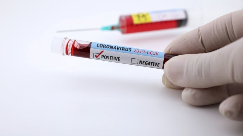 Първа жертва на коронавируса в Гърция