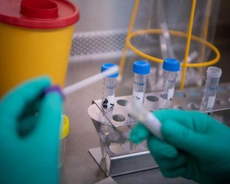 Лабораториите се задъхват! Пловдивчани чакат резултатите си за коронавирус с дни