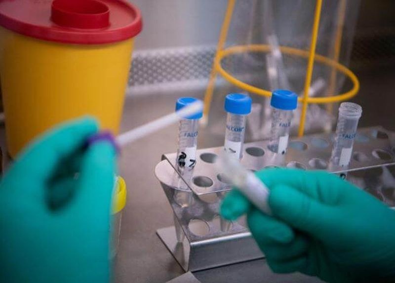 Лабораториите се задъхват! Пловдивчани чакат резултатите си за коронавирус с дни