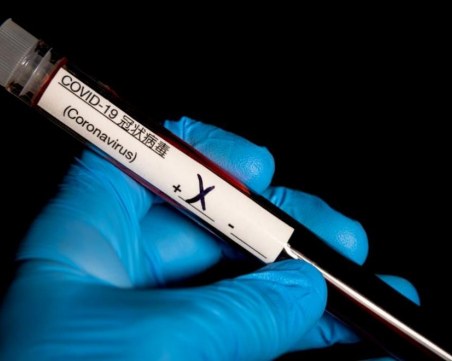 Черна статистика: Италия регистрира рекорден брой смъртни случаи за 24 часа