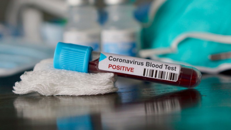 Българин от Сингапур е заразен с COVID-19