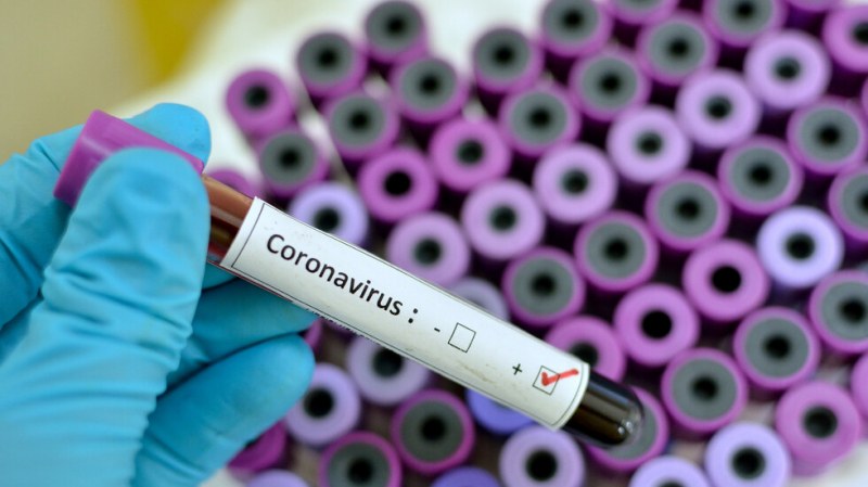 Три нови лаборатории ще тестват за COVID-19, едната - в Пловдив