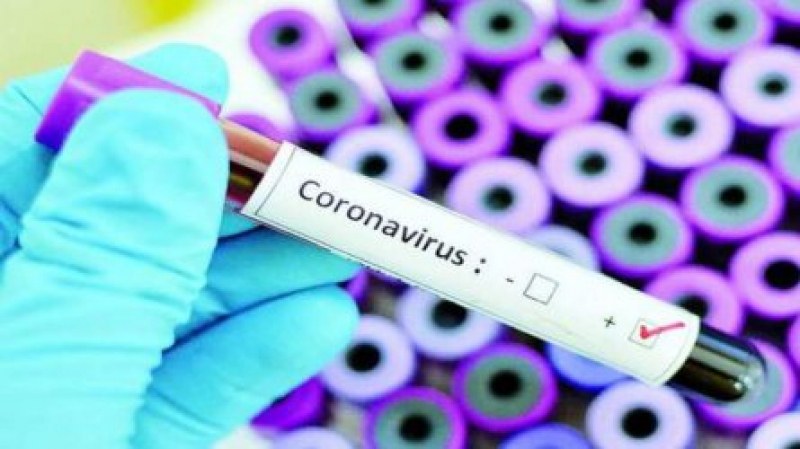 Първи смъртен случай от коронавирус в Чехия