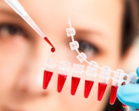 Професор Аргирова: Пикът ще е през май