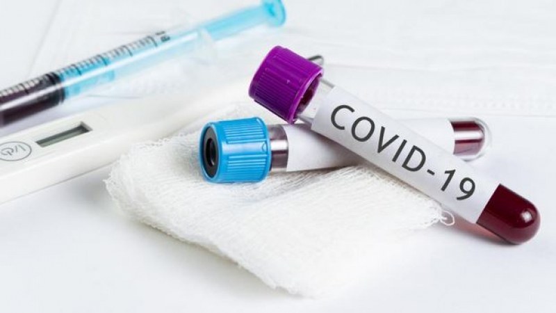 420 пловдивчани общо са тествани за COVID-19, от тях 126 медици