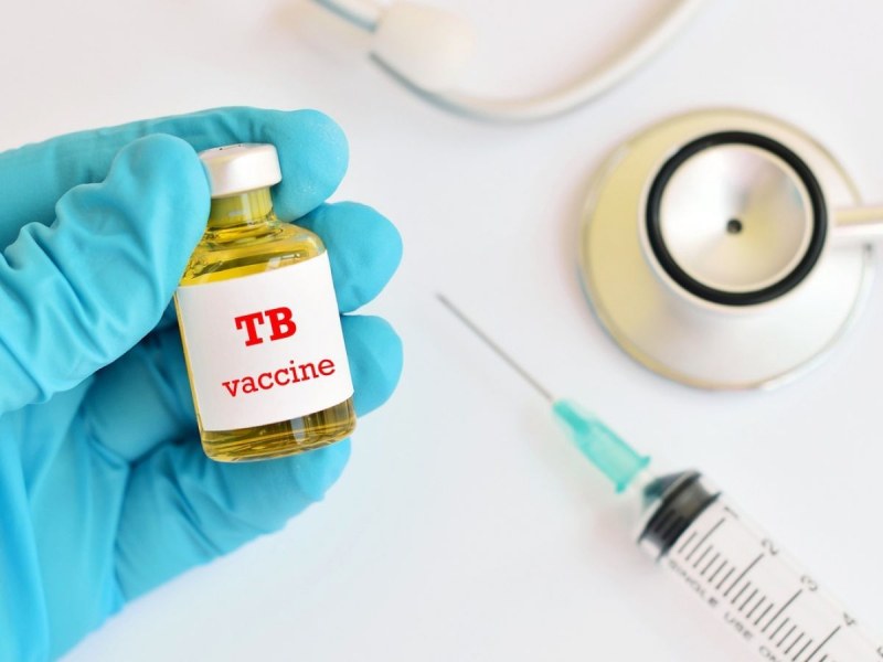 Държавите без имунизация против туберкулоза дават повече жертви от COVID-19