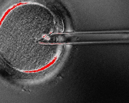 Пловдивчанка с научен пробив в Англия – разгада непознати имунни механизми