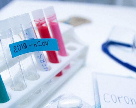 Софиянец без симптоми даде положителен резултат на IgG антитела на SARS-CoV-2