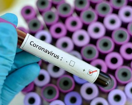 Тестовете за COVID-19 у нас на свършване, изследвани са средно по 2200 души на 1 млн. население