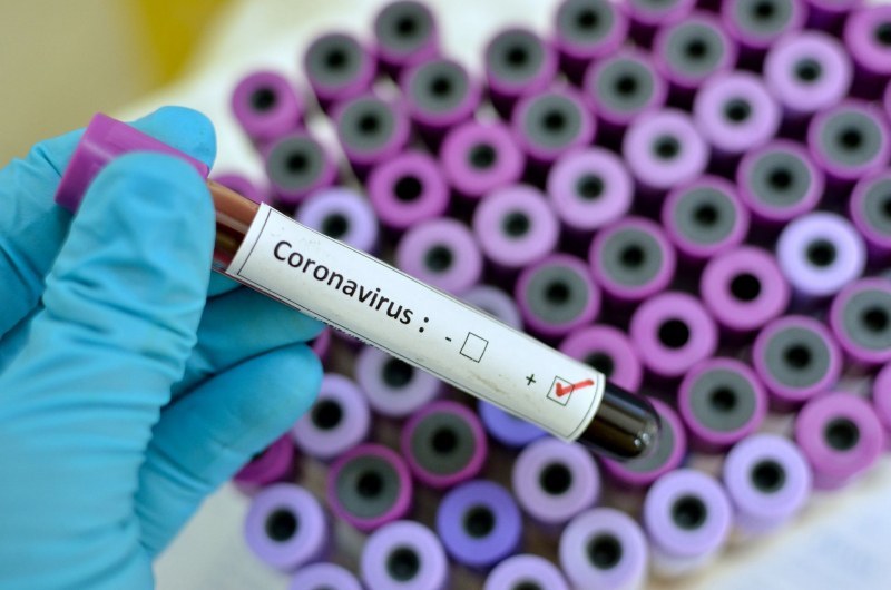 11 нови случаи на COVID-19, заразените вече са 635