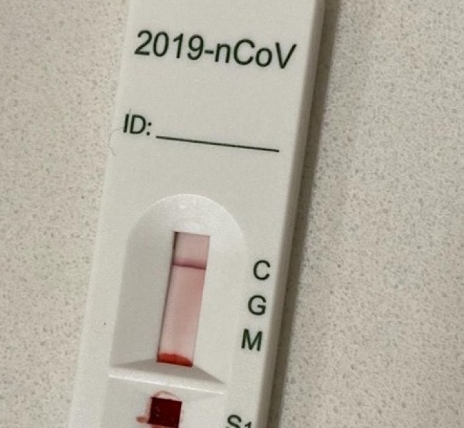 С 1 PCR тест могат да се тестват 20 души