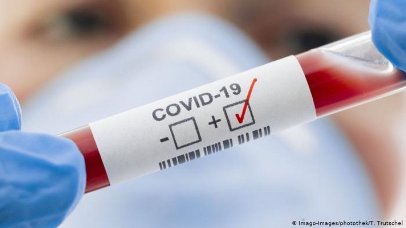 685 са потвърдените случаи на COVID-19 у нас