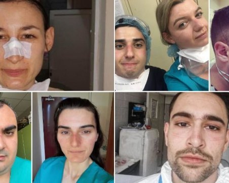 Български лекари показаха следите от маските по лицата си