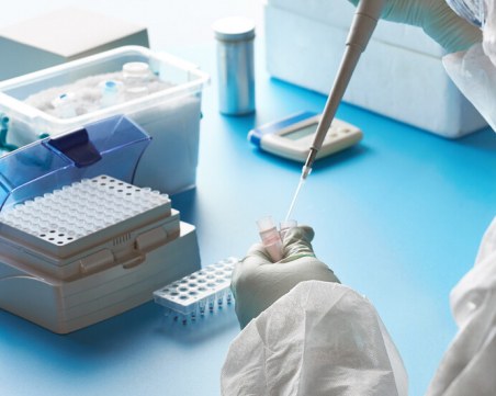 Болните в Щатите вече са над 728 000, обнадеждаващи данни за няколко страни в Европа