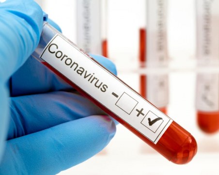 Мъж и жена починаха от COVID-19! Нови 15 случаи у нас