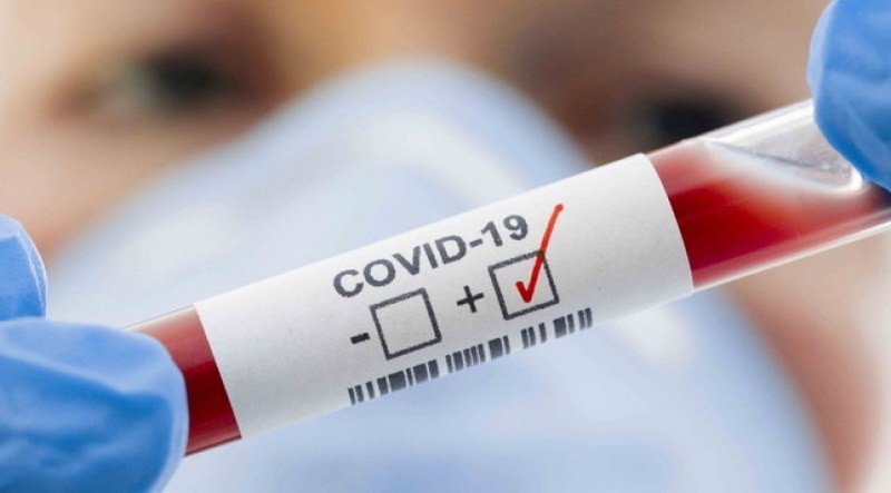 Първата положителна проба за COVID-19 във Франция била взета през декември