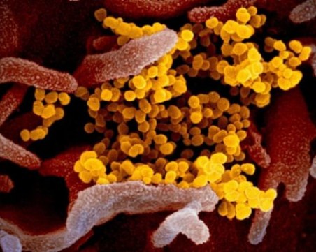 Разработиха революционен тест за откриване на коронавирус