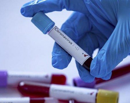 СЗО призова страните да се разровят за по-ранни случаи на коронавирус