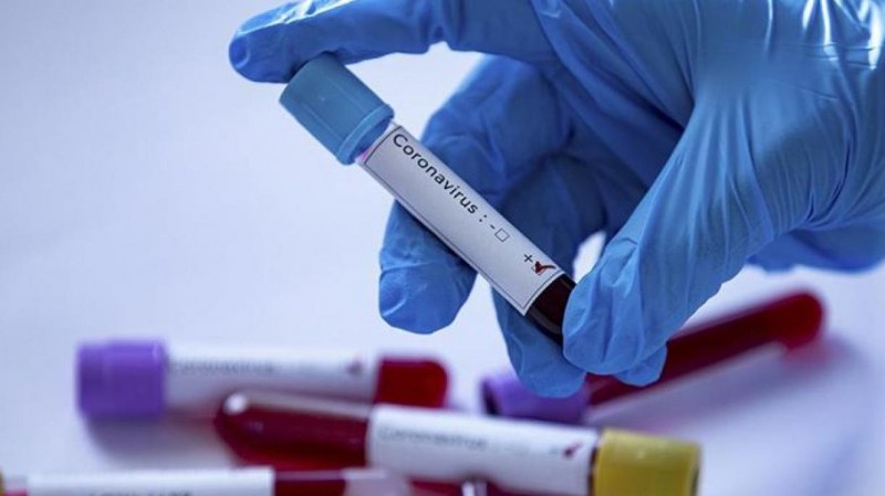 СЗО призова страните да се разровят за по-ранни случаи на коронавирус