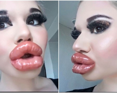 BG Барби с 20-та инжекция хиалурон, гони рекорд на Гинес за най-големи устни в света