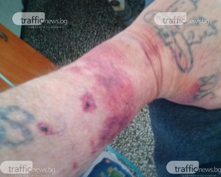 Пловдивчанин: В Окръжна болница ме нарекоха 