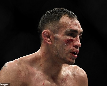Тони Фергюсън с лоша контузия след ударите на Джъстин Гейджи