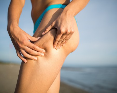 7 мита за целулита, в които да спрете да вярвате