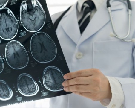 Инсултите са 