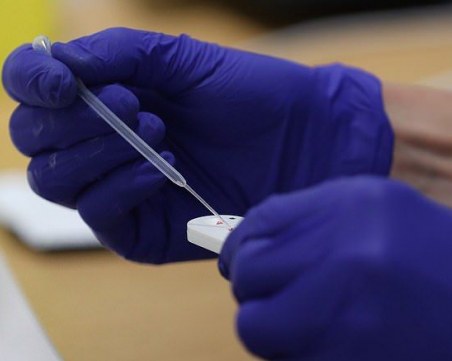 Имунитетът срещу COVID-19 може би трае само 6 месеца