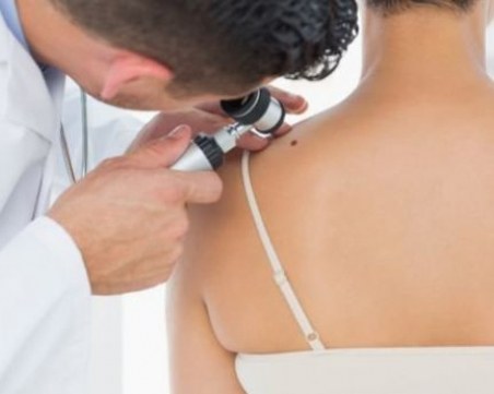 Дерматолог: Все повече са случаите на рак на кожата
