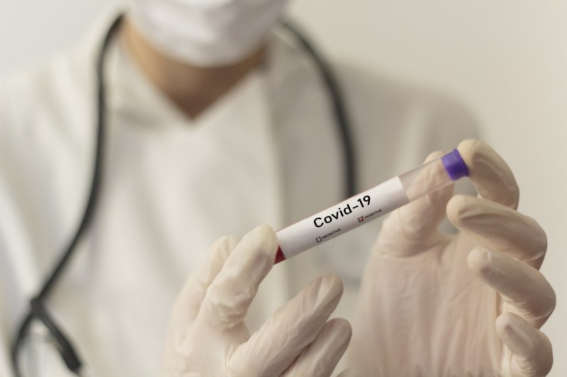 д-р Богдан Петрунов: Едва10% от хората по света са с имунитет срещу COVID-19