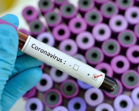 Мъж почина в Пловдив от Covid-19, новозаразените се увеличават