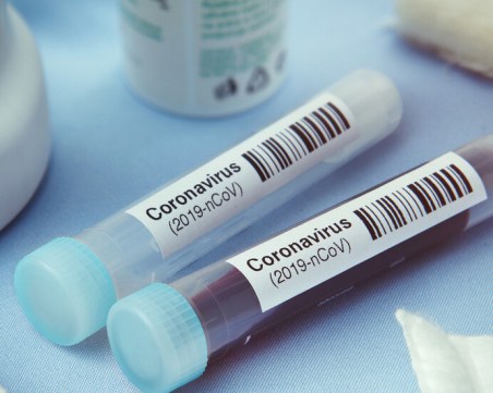 Още 13 заразени с COVID-19 в Сърница