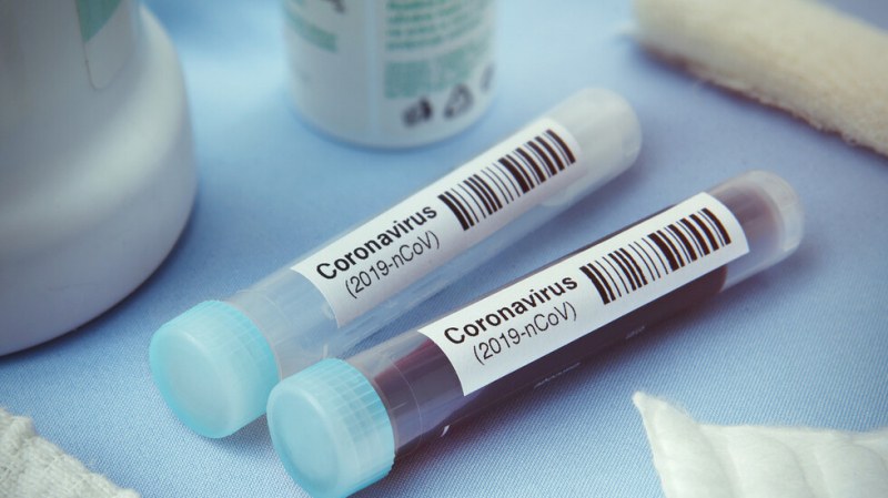 Още 13 заразени с COVID-19 в Сърница