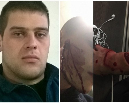 Обвиниха полицая, нарязал фен на Локото