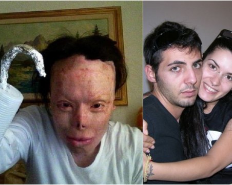 Валентина остава без уши, нос и ръка заради ревността на мъжа си