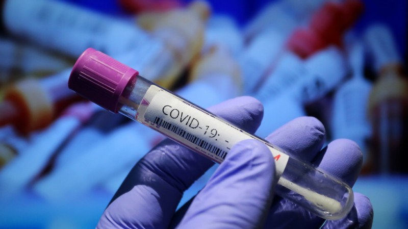 Рекорден брой нови случаи на Covid-19 за 24 часа, заразените вече са над 13 000 000