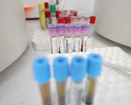 Още един случай на коронавирус в детска градина