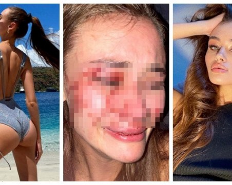 Топ моделът Дария Кирилюк жестоко пребита от охрана в турски бийч бар